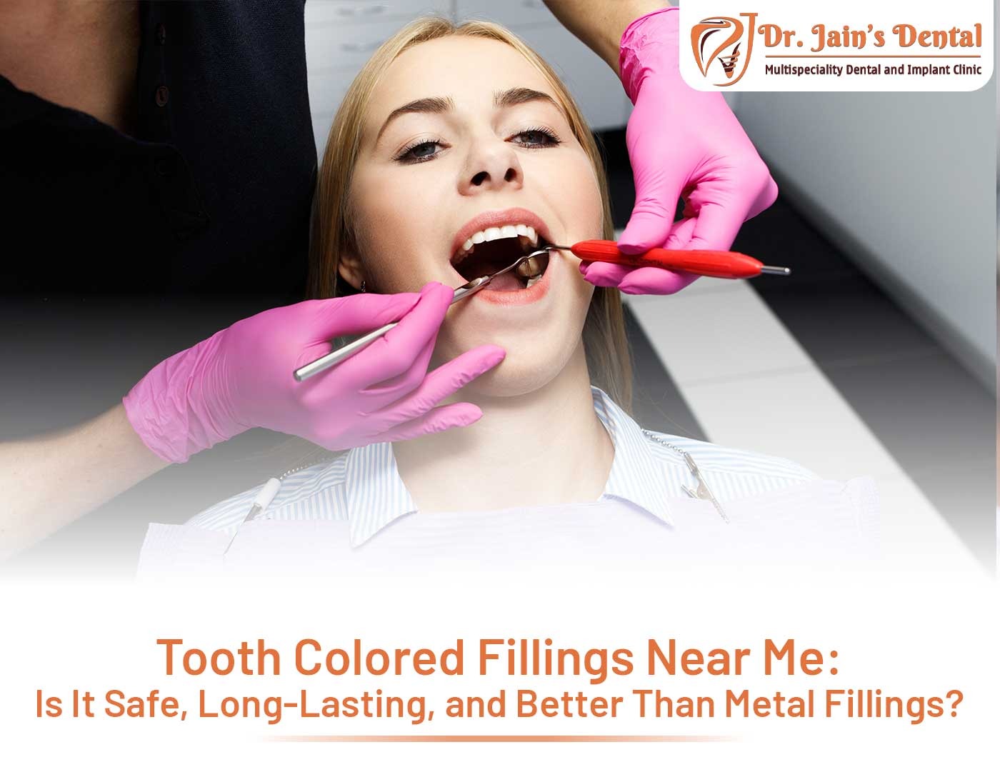 Tooth Colored Fillings Near Me: Is It Safe, Long-Lasting, and Better Than Metal Fillings?